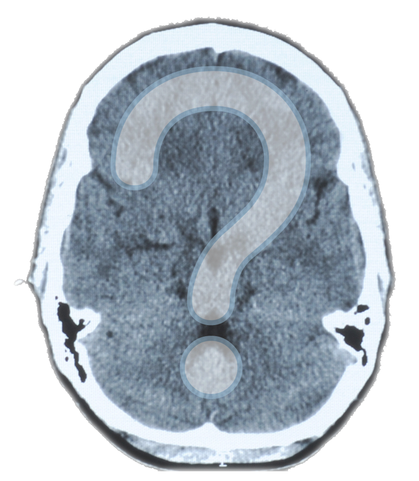 Image of the brain showing the importance of identifying mutations through imaging, biopsy, and other methods
