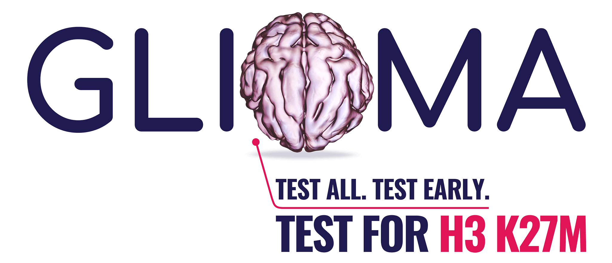Stylized GLIOMA hero with a brain image as the O indicating the importance of testing for H3 K27M mutation in all diffuse gliomas